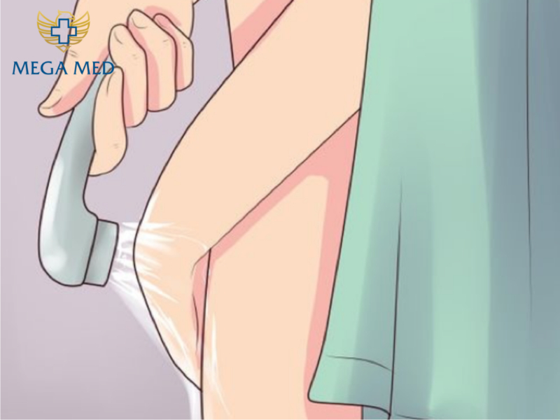 Vệ sinh “cậu nhỏ” sau cắt bao quy đầu